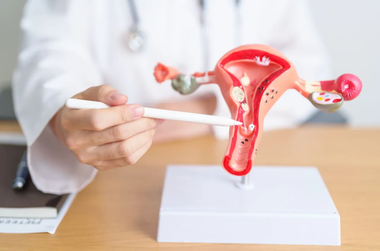 Médico de Familia y/o ginecólogo explicando el cáncer cervical, afección relacionada al VPH.