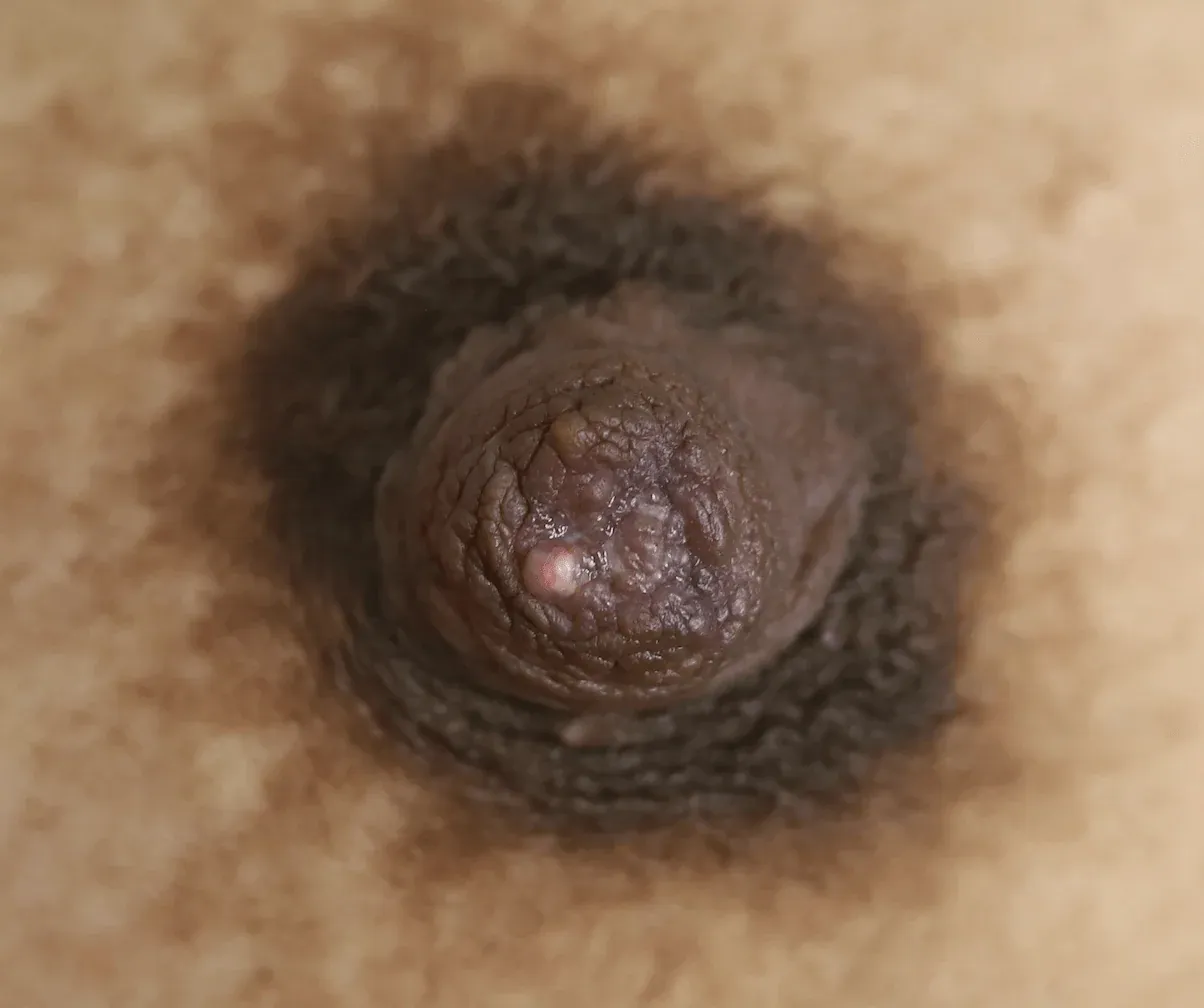 Pezon oscuro con perlita de leche.