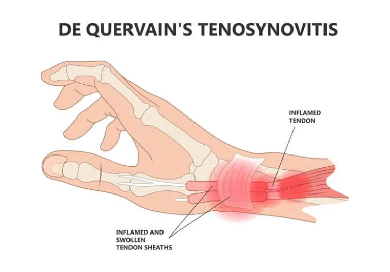 Anatomía de la muñeca