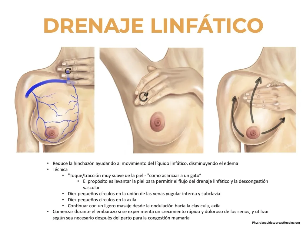 Diagrama explicando como se hace un drenaje limfático en las mamas.